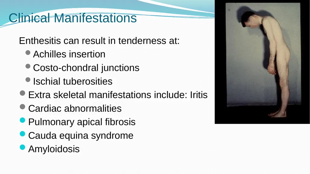 1 Subject : Orthopedic and Neurovascular Nursing - slide 33 of 61