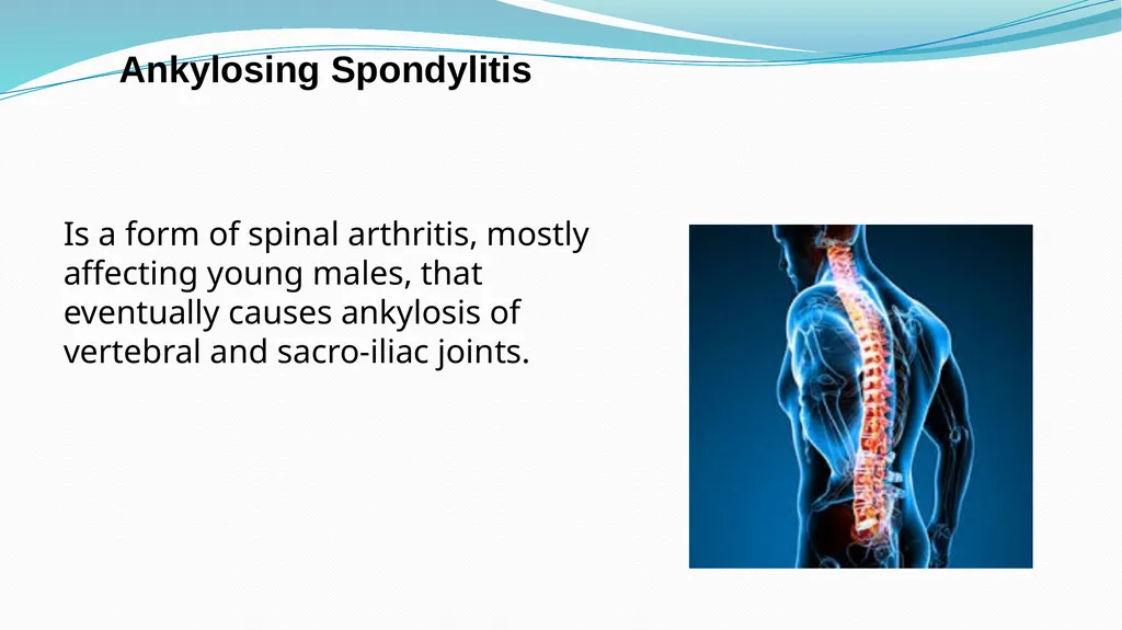 1 Subject : Orthopedic and Neurovascular Nursing - slide 27 of 61