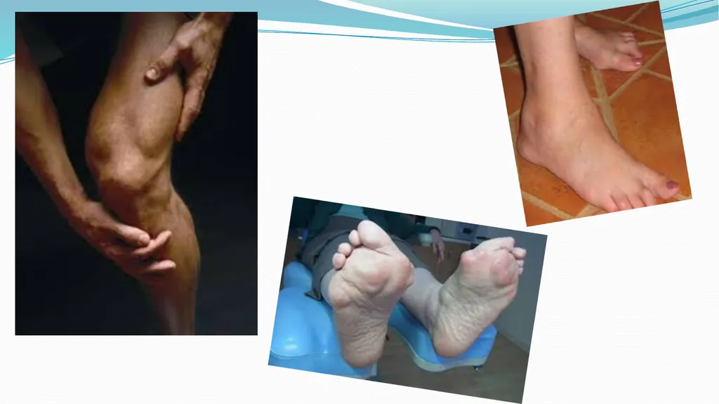 1 Subject : Orthopedic and Neurovascular Nursing - slide 10 of 61