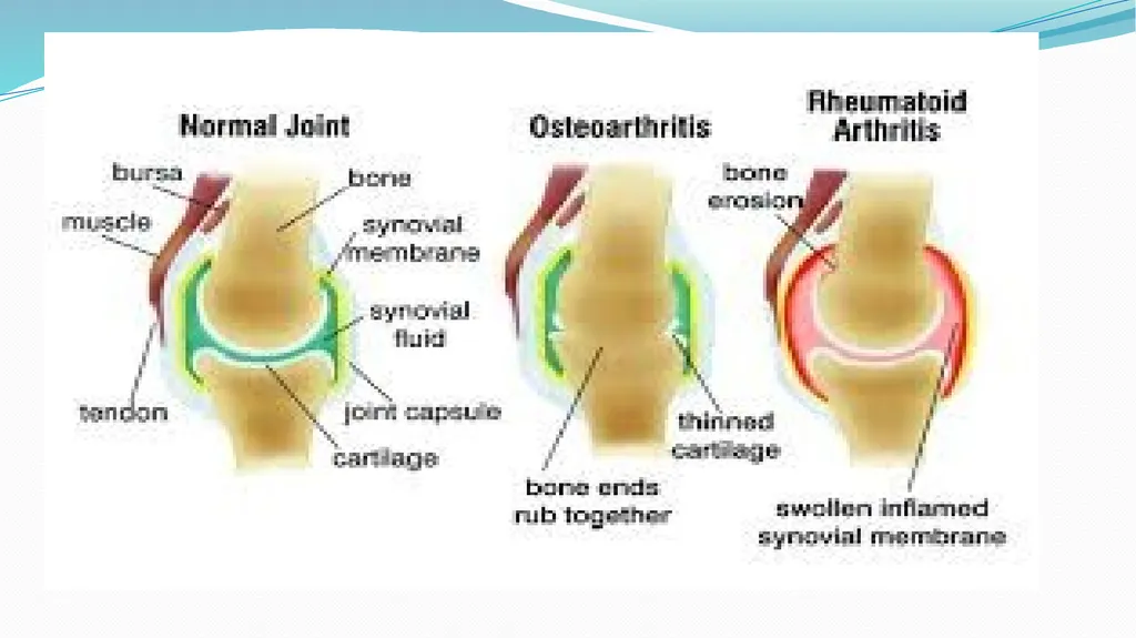 1 Subject : Orthopedic and Neurovascular Nursing - slide 11 of 61
