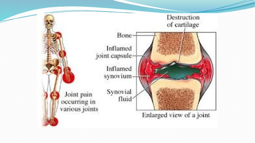 1 Subject : Orthopedic and Neurovascular Nursing - slide 12 of 61