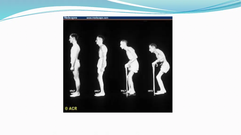 1 Subject : Orthopedic and Neurovascular Nursing - slide 39 of 61