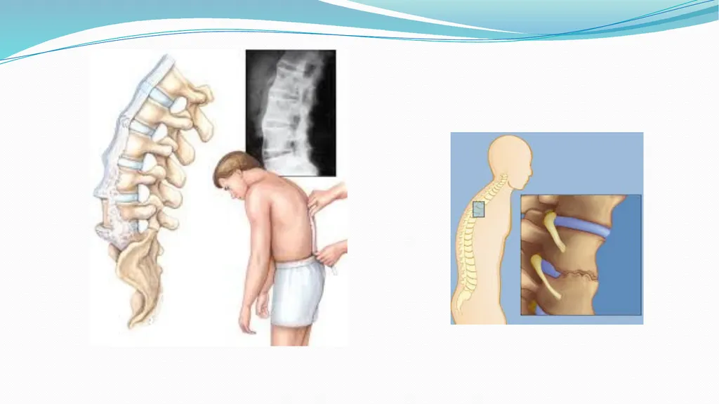 1 Subject : Orthopedic and Neurovascular Nursing - slide 40 of 61