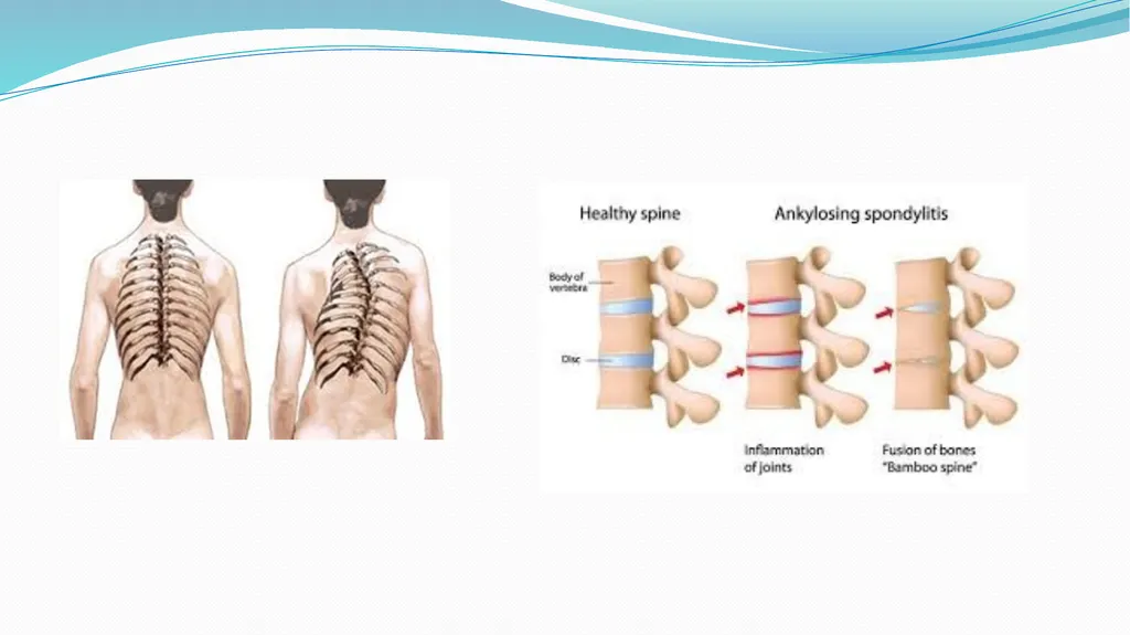 1 Subject : Orthopedic and Neurovascular Nursing - slide 41 of 61