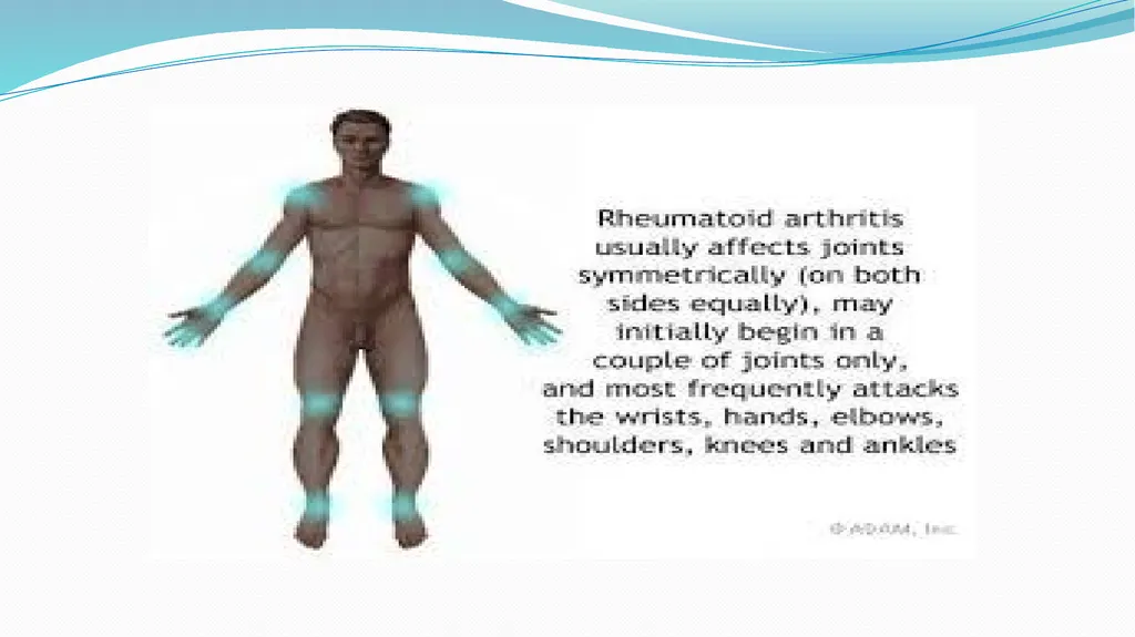 1 Subject : Orthopedic and Neurovascular Nursing - slide 6 of 61