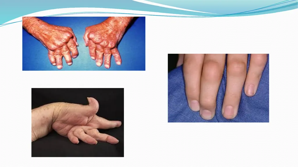 1 Subject : Orthopedic and Neurovascular Nursing - slide 7 of 61