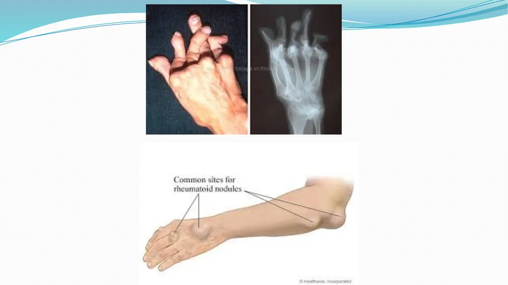 1 Subject : Orthopedic and Neurovascular Nursing - slide 8 of 61