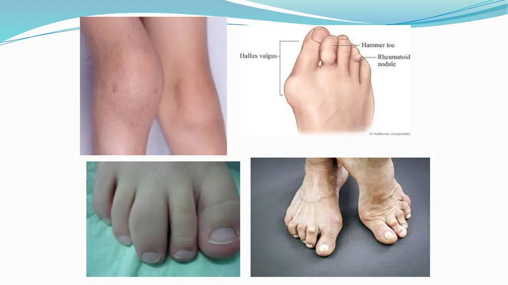 1 Subject : Orthopedic and Neurovascular Nursing - slide 9 of 61