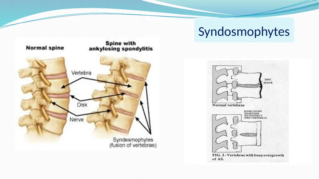 1 Subject : Orthopedic and Neurovascular Nursing - slide 35 of 61