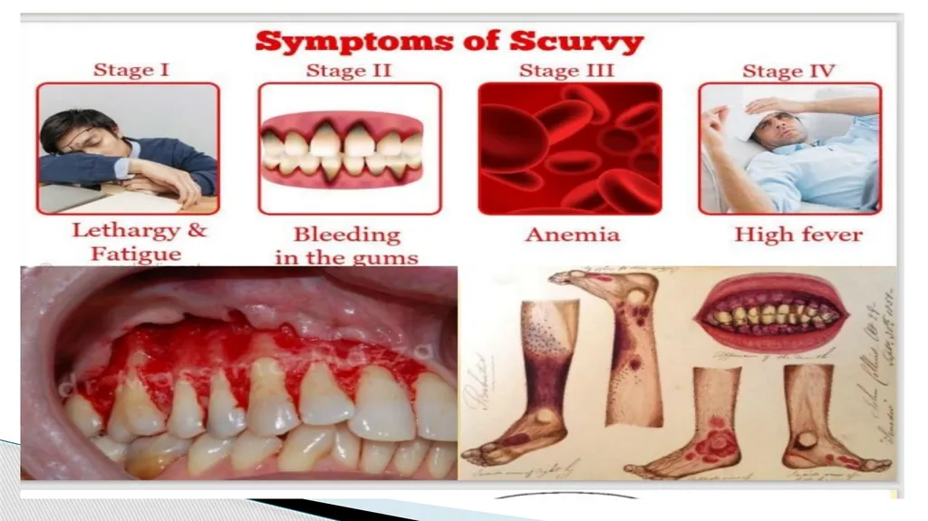 Vitamins (Water Soluble) Dr. Dharmendra Kumar - slide 6 of 34