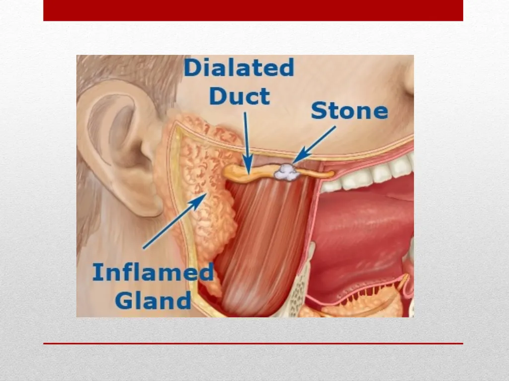 Saliva It is a watery secretion in the mouth - slide 28 of 29