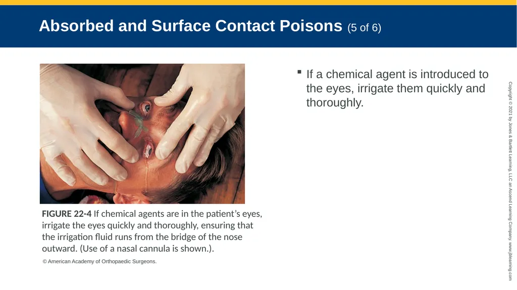 CHAPTER 22 Toxicology National EMS Education - slide 22 of 131