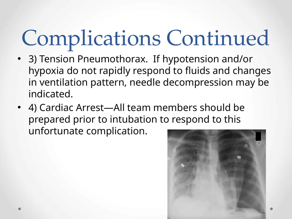 Status Asthmaticus in the Pediatric Emergency - slide 52 of 66