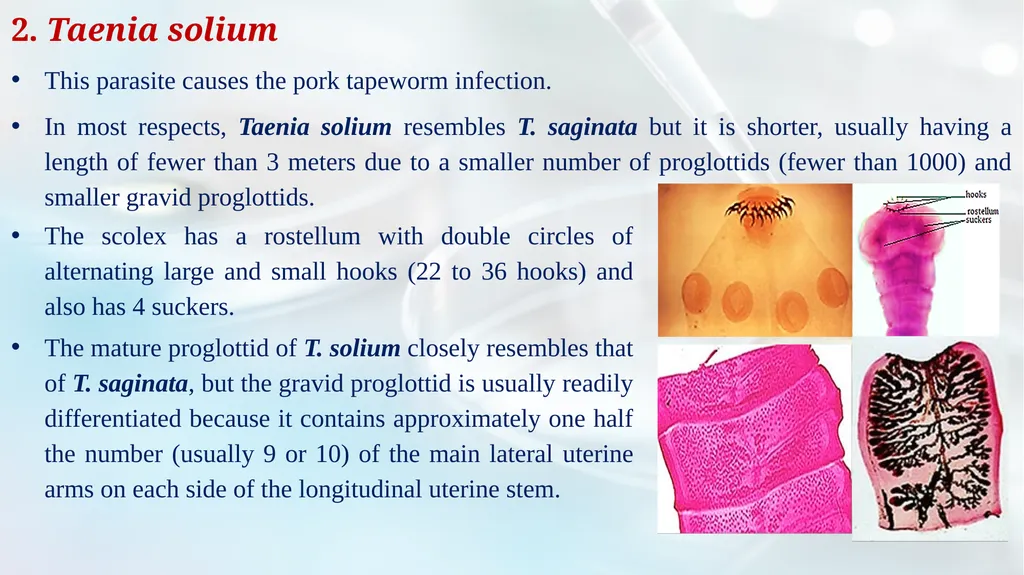 Lecture 5 Helminths-Cestodes Medical Parasitology - slide 9 of 27