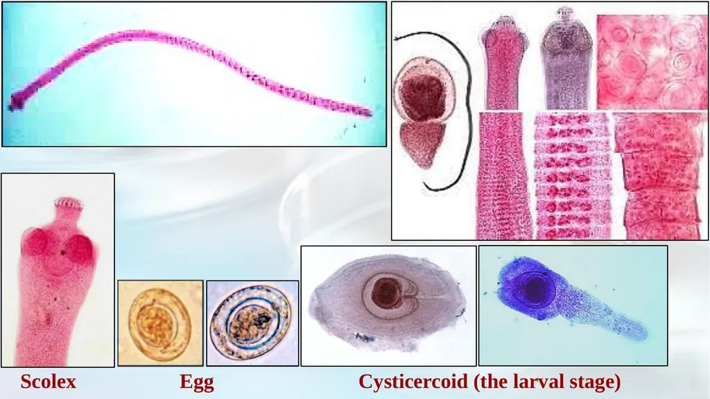 Lecture 5 Helminths-Cestodes Medical Parasitology - slide 15 of 27