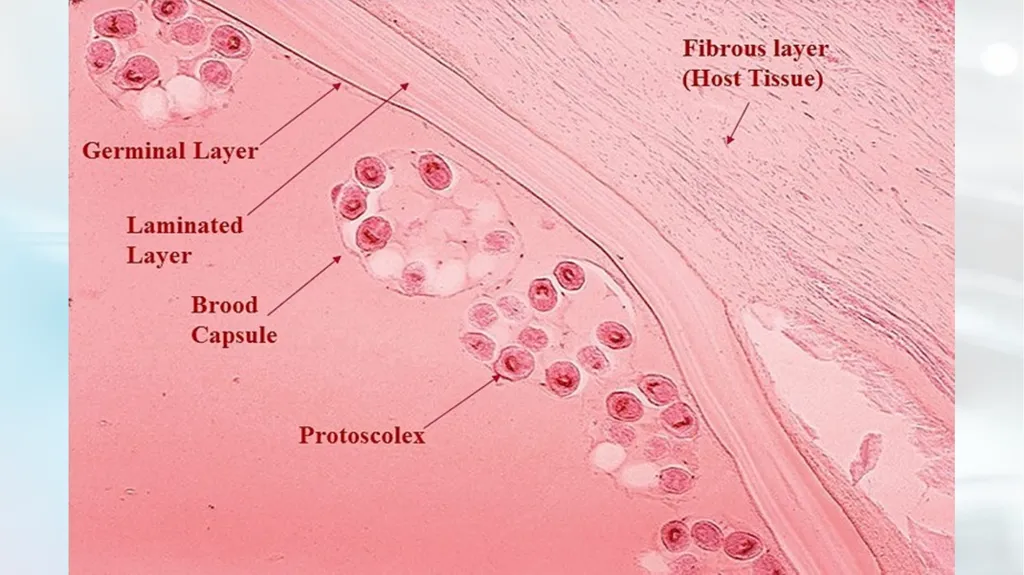 Lecture 5 Helminths-Cestodes Medical Parasitology - slide 22 of 27