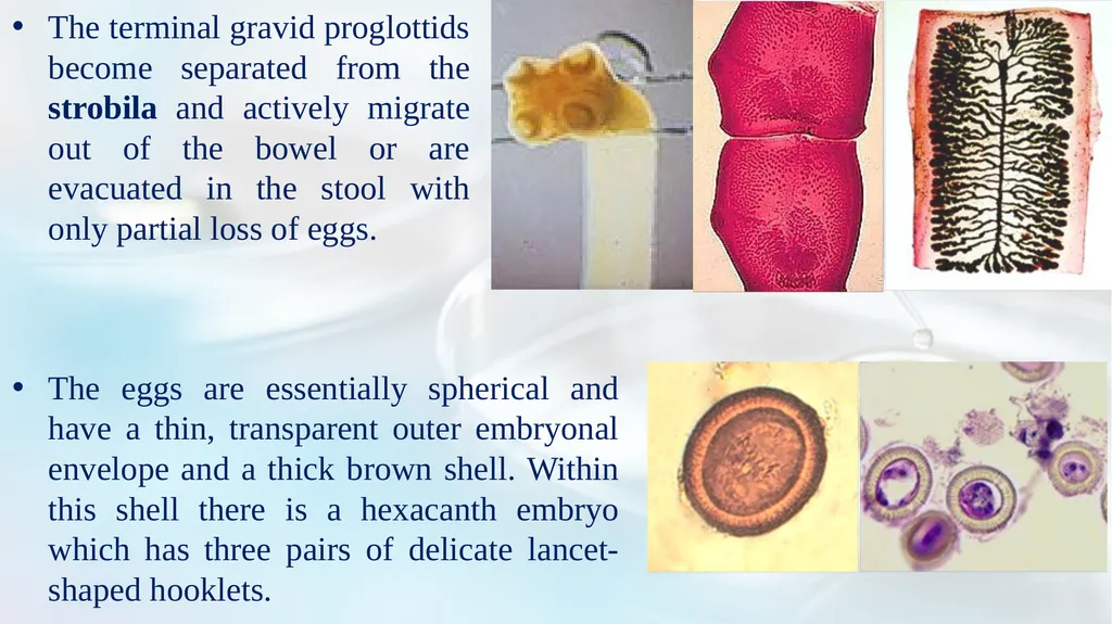 Lecture 5 Helminths-Cestodes Medical Parasitology - slide 4 of 27