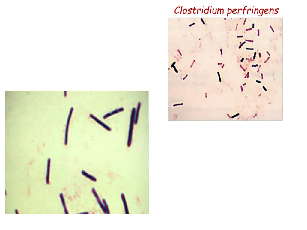Date-22/1/2021 Part -11 2nd year professional - slide 3 of 26