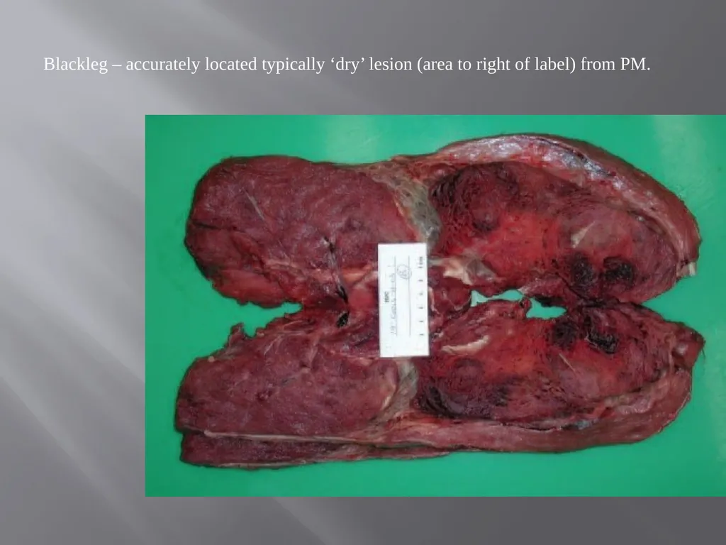 CLOSTRIDIAL DISEASES Introduction Clostridial - slide 54 of 55