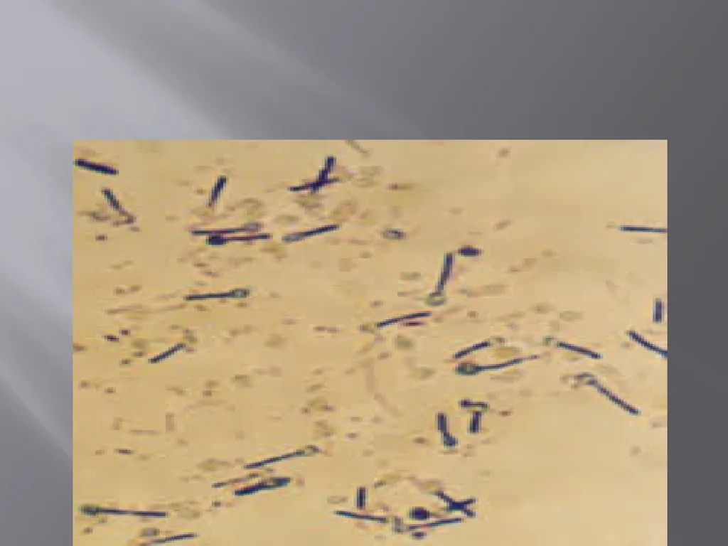 CLOSTRIDIAL DISEASES Introduction Clostridial - slide 12 of 55