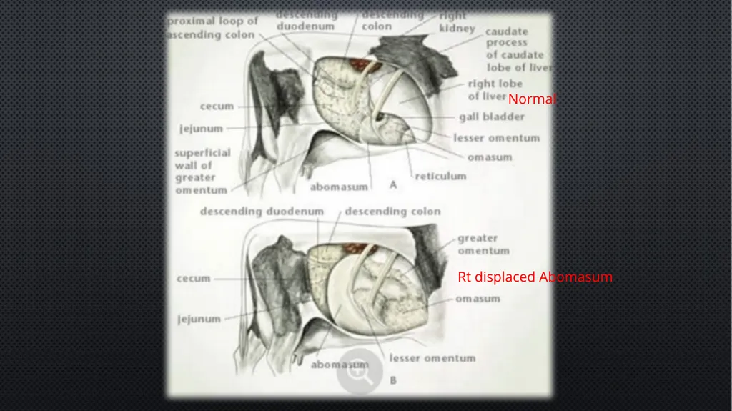 Ruminant Stomach –Abomasal displacement Gulshan - slide 6 of 16