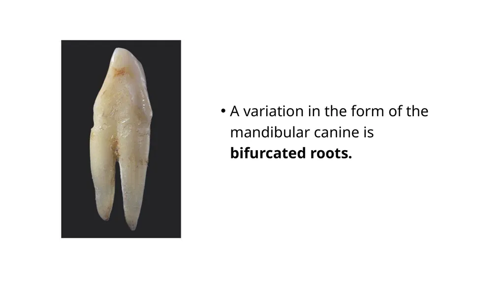 The Permanent Canines: Maxillary and Mandibular - slide 24 of 36