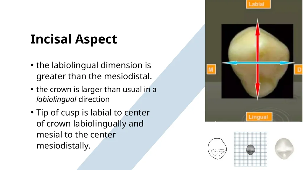 The Permanent Canines: Maxillary and Mandibular - slide 20 of 36