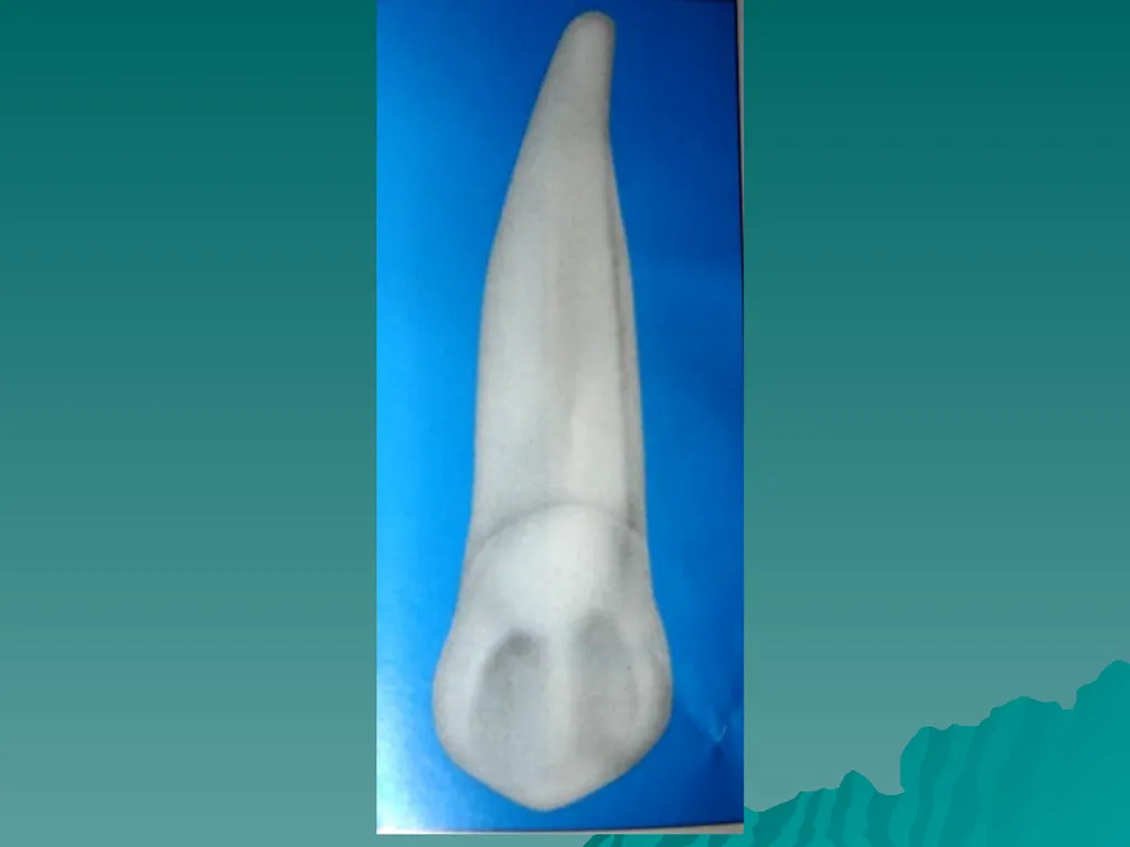 MORPHOLOGY OF PERMANENT CANINES INTRODUCTION Four - slide 15 of 22