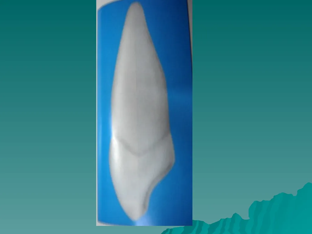 MORPHOLOGY OF PERMANENT CANINES INTRODUCTION Four - slide 18 of 22