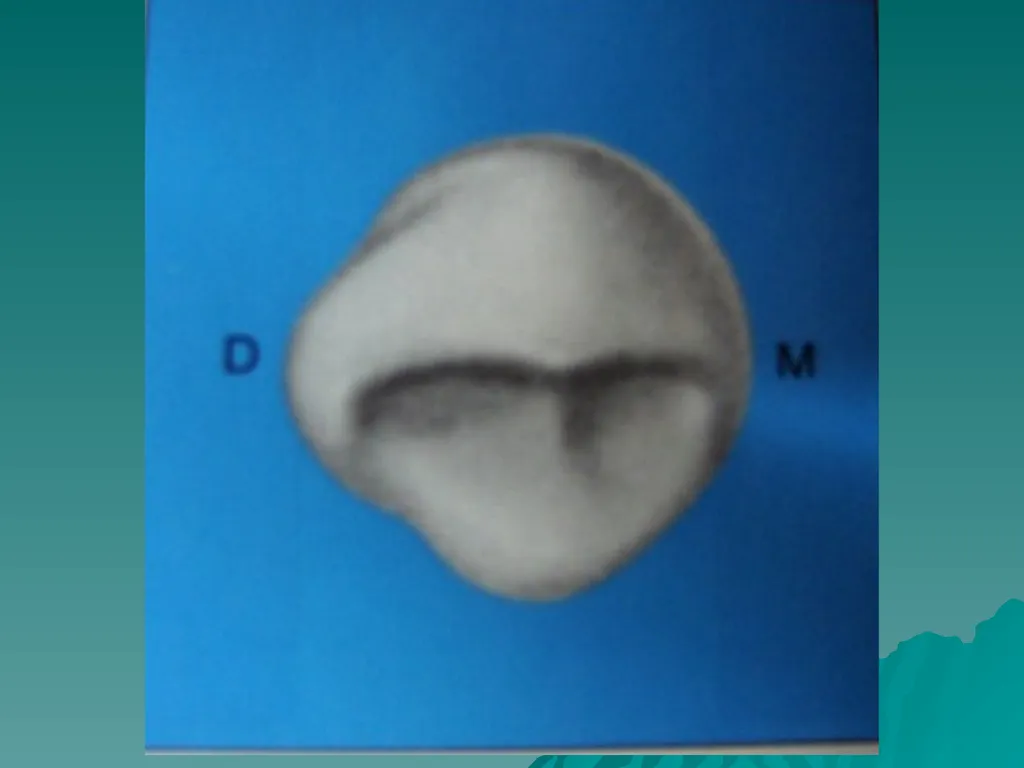 MORPHOLOGY OF PERMANENT CANINES INTRODUCTION Four - slide 22 of 22