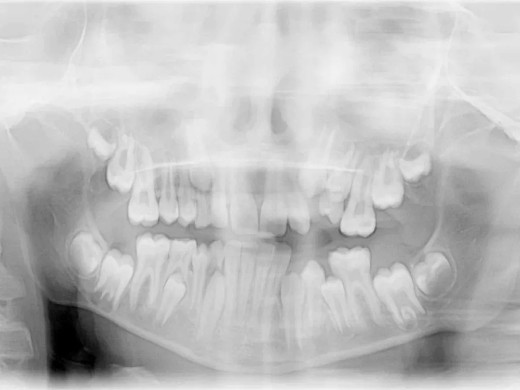 Tooth Morphology (the study of the form of teeth) - slide 43 of 69
