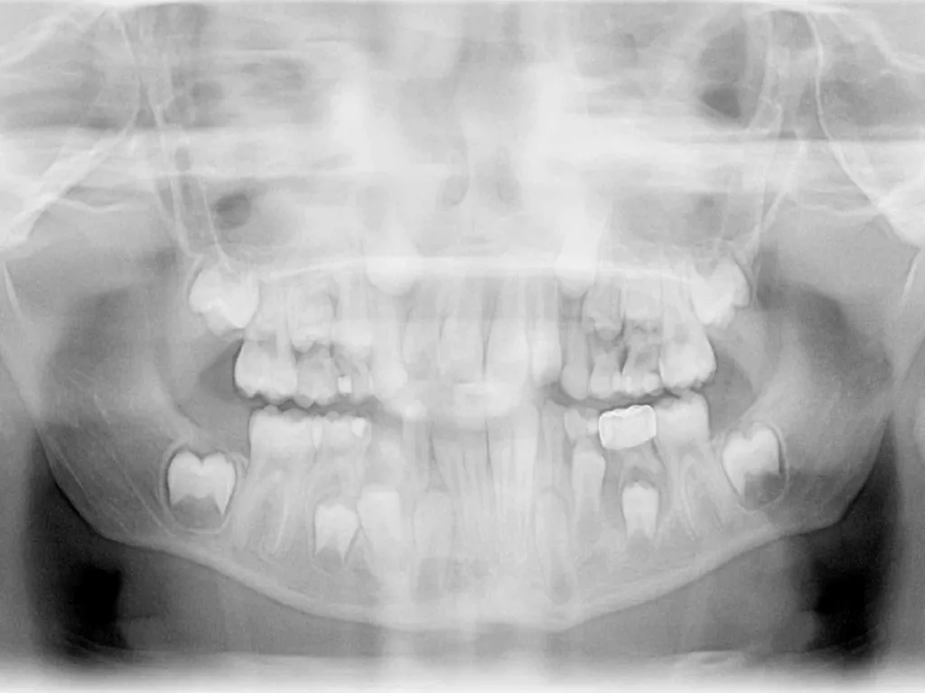 Tooth Morphology (the study of the form of teeth) - slide 44 of 69