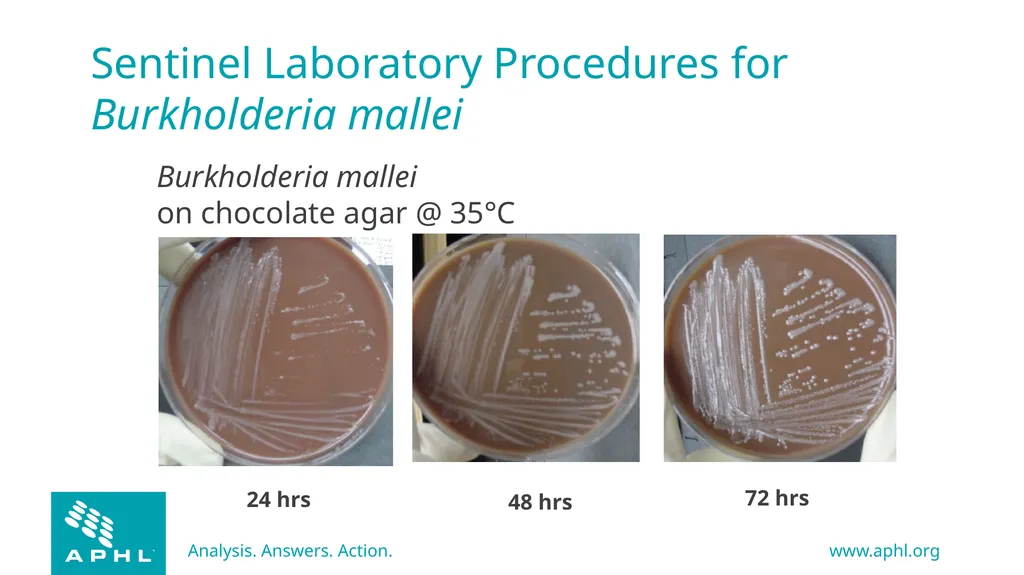 Agents of Bioterrorism Burkholderia species - slide 17 of 30