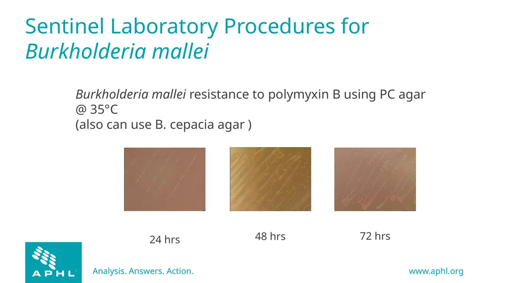 Agents of Bioterrorism Burkholderia species - slide 23 of 30
