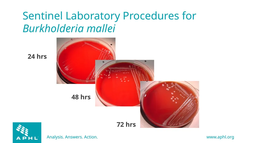 Agents of Bioterrorism Burkholderia species - slide 14 of 30