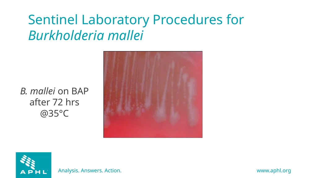 Agents of Bioterrorism Burkholderia species - slide 15 of 30