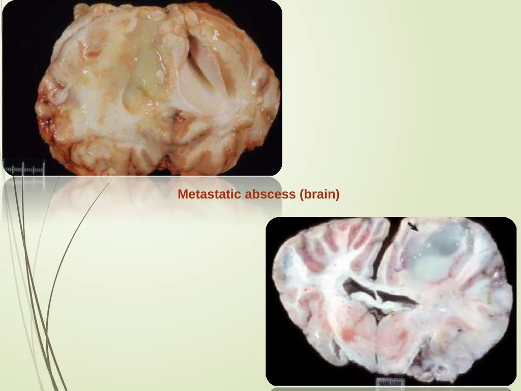 Equine Diseases (Strangles) Post Mortem Assistant - slide 7 of 8