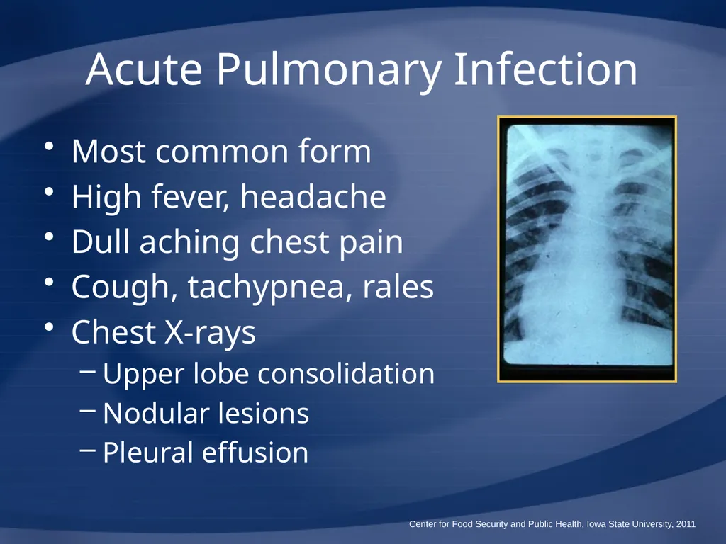 Melioidosis Pseudoglanders Whitmore Disease - slide 18 of 31