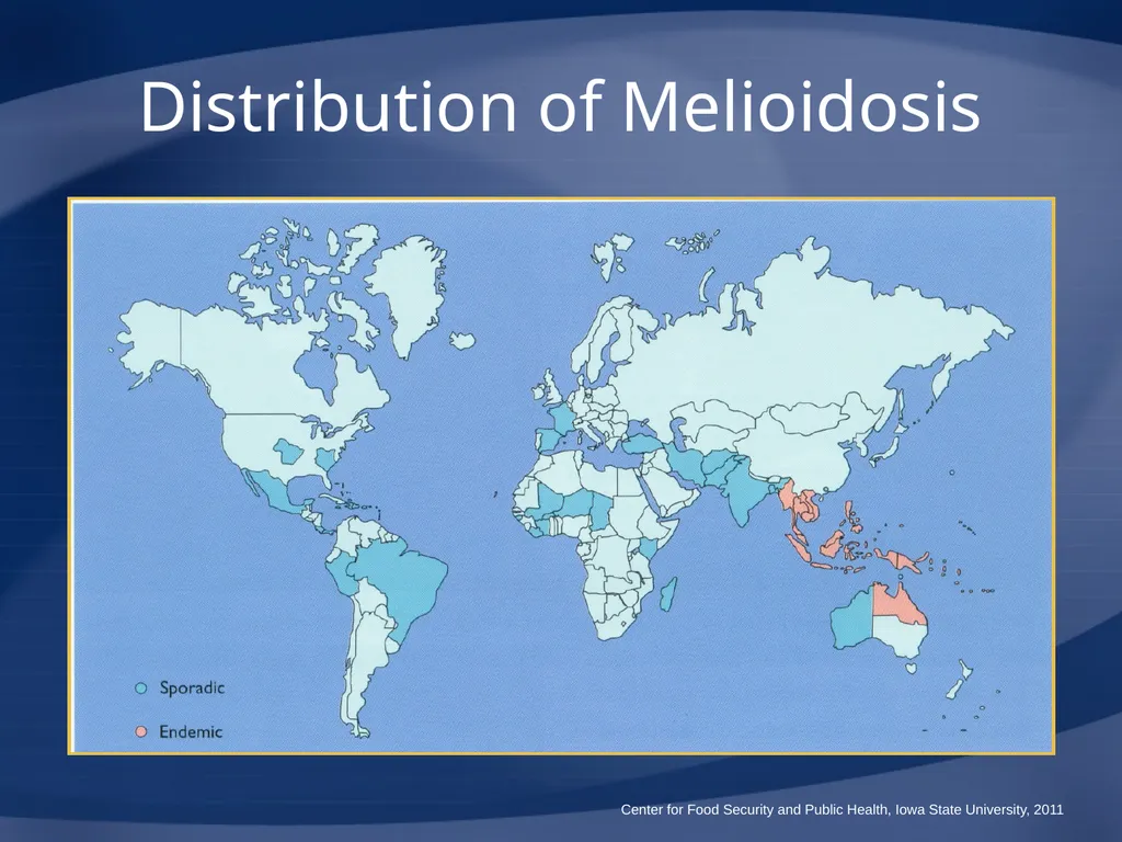 Melioidosis Pseudoglanders Whitmore Disease - slide 14 of 31