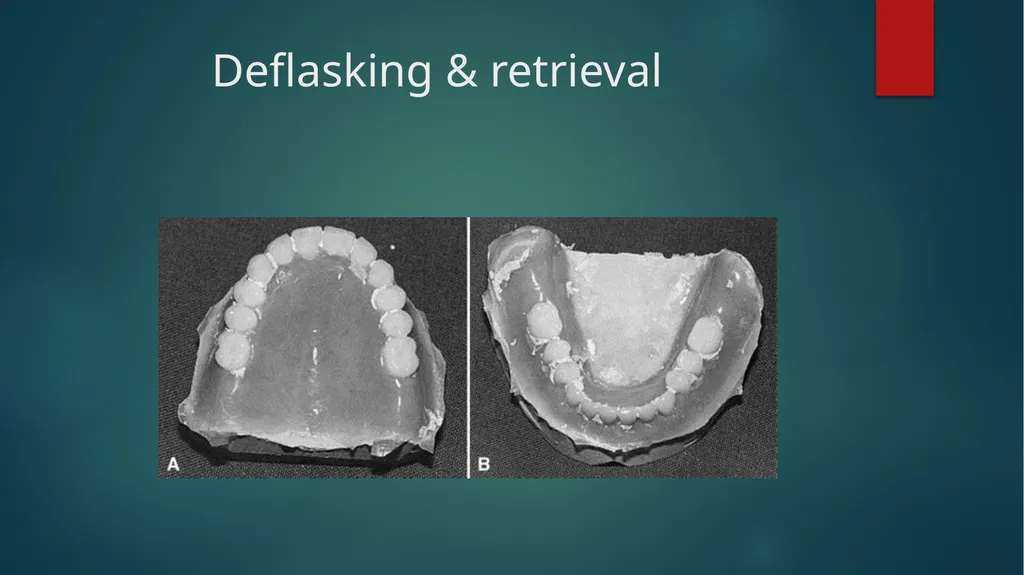 Laboratory Procedures for Complete Dentures - slide 17 of 24