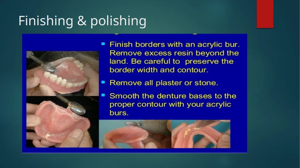 Laboratory Procedures for Complete Dentures - slide 22 of 24