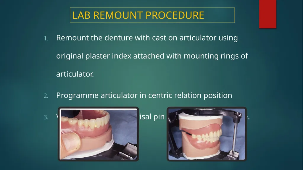 Laboratory Procedures for Complete Dentures - slide 18 of 24