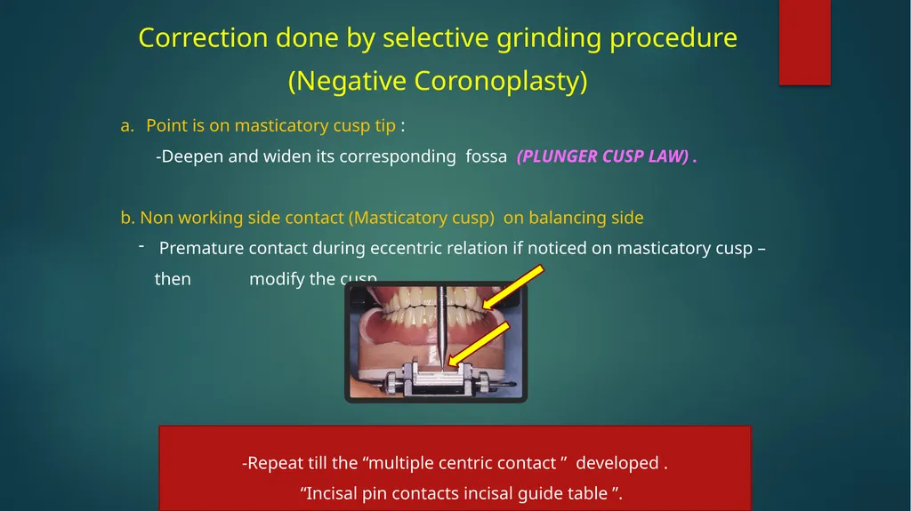 Laboratory Procedures for Complete Dentures - slide 20 of 24