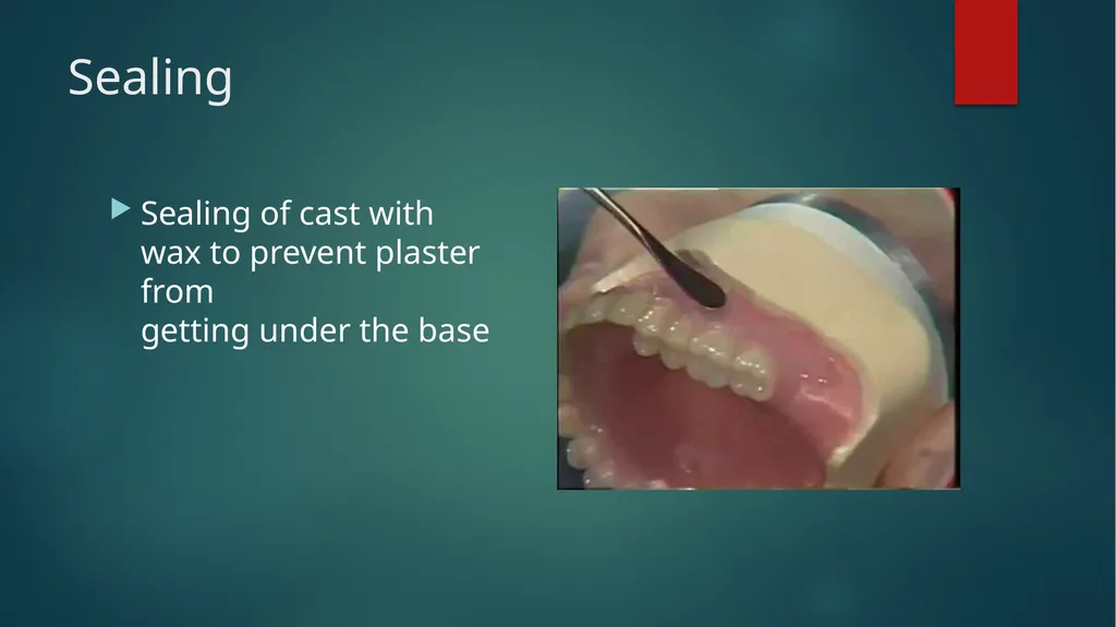 Laboratory Procedures for Complete Dentures - slide 4 of 24