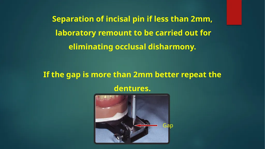Laboratory Procedures for Complete Dentures - slide 19 of 24