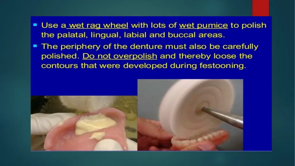 Laboratory Procedures for Complete Dentures - slide 23 of 24