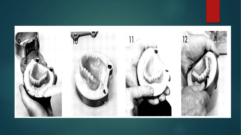 Laboratory Procedures for Complete Dentures - slide 6 of 24