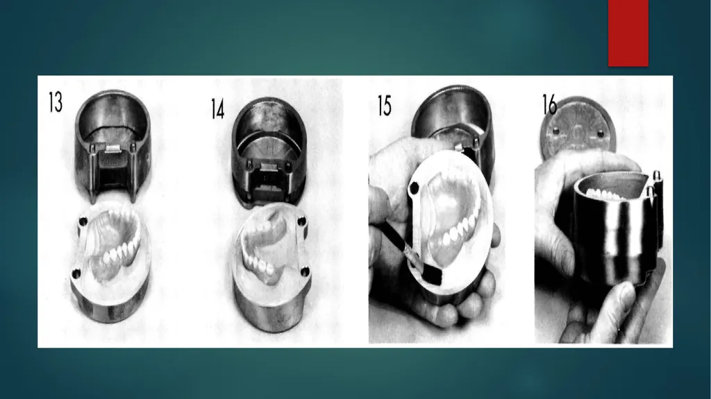 Laboratory Procedures for Complete Dentures - slide 7 of 24