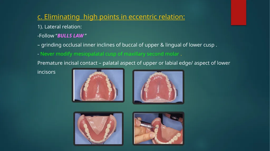 Laboratory Procedures for Complete Dentures - slide 21 of 24