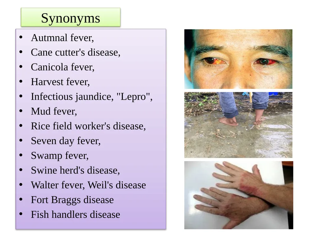Leptospirosis is a bacterial disease that affects - slide 2 of 28
